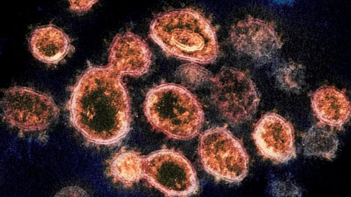 This 2020 electron microscope image provided by the National Institute of Allergy and Infectious Diseases — Rocky Mountain Laboratories shows SARS-CoV-2 virus particles, which cause COVID-19, isolated from a patient in the U.S. and emerging from the surface of cells cultured in a lab. (NIAID-RML | AP)