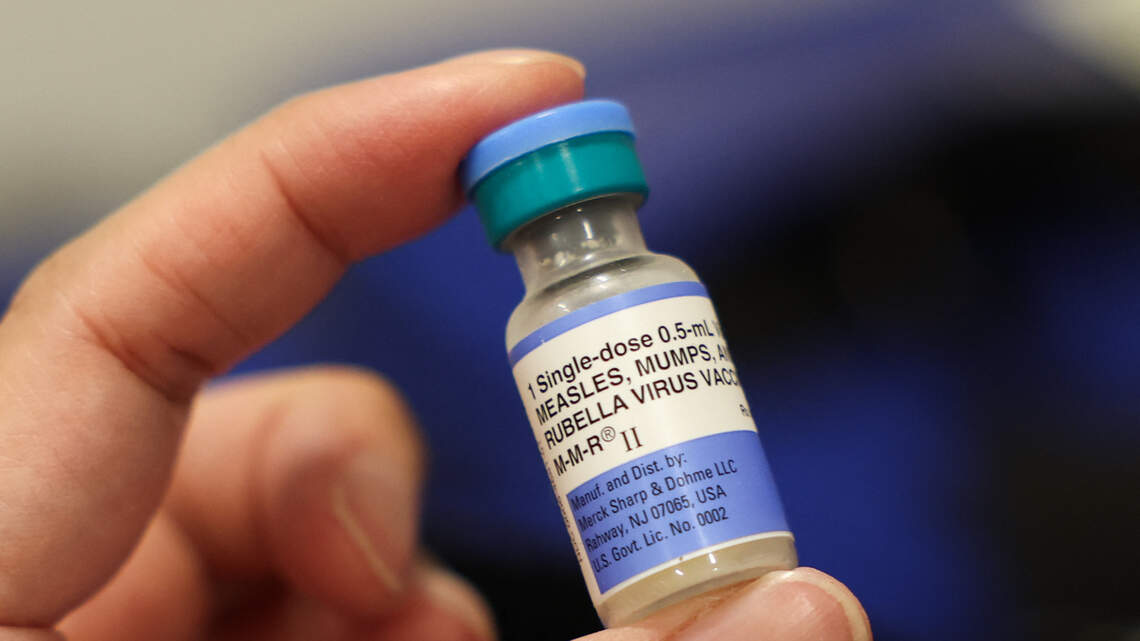 Trumbull County Combined Health District reports measles exposure from horse auction