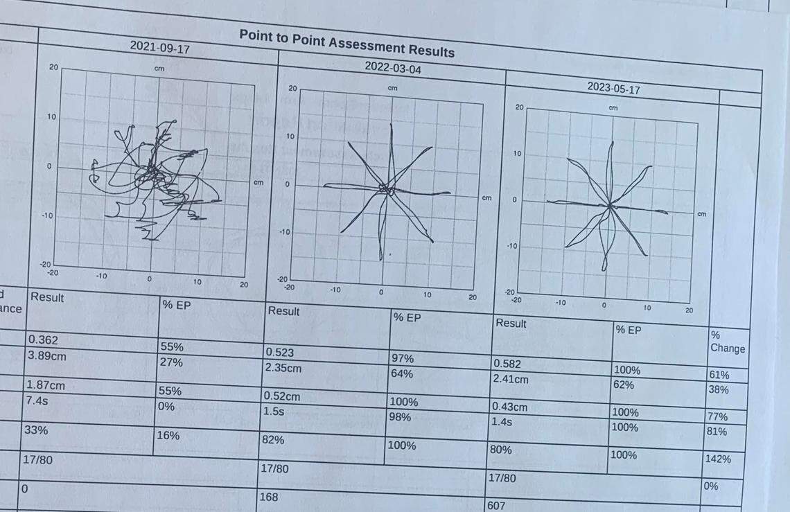 Chart showing Tracy’s progress from 2021 to 2023 using data from mobility training with InMotion robotic arm