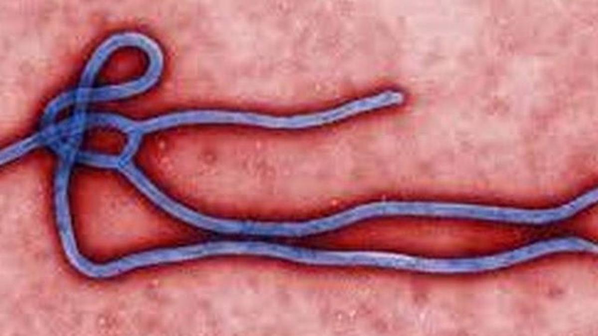 Health officials in Washington are monitoring 23 people for Ebola after they traveled to West African countries experiencing outbreaks. (Centers for Disease Control and Prevention)