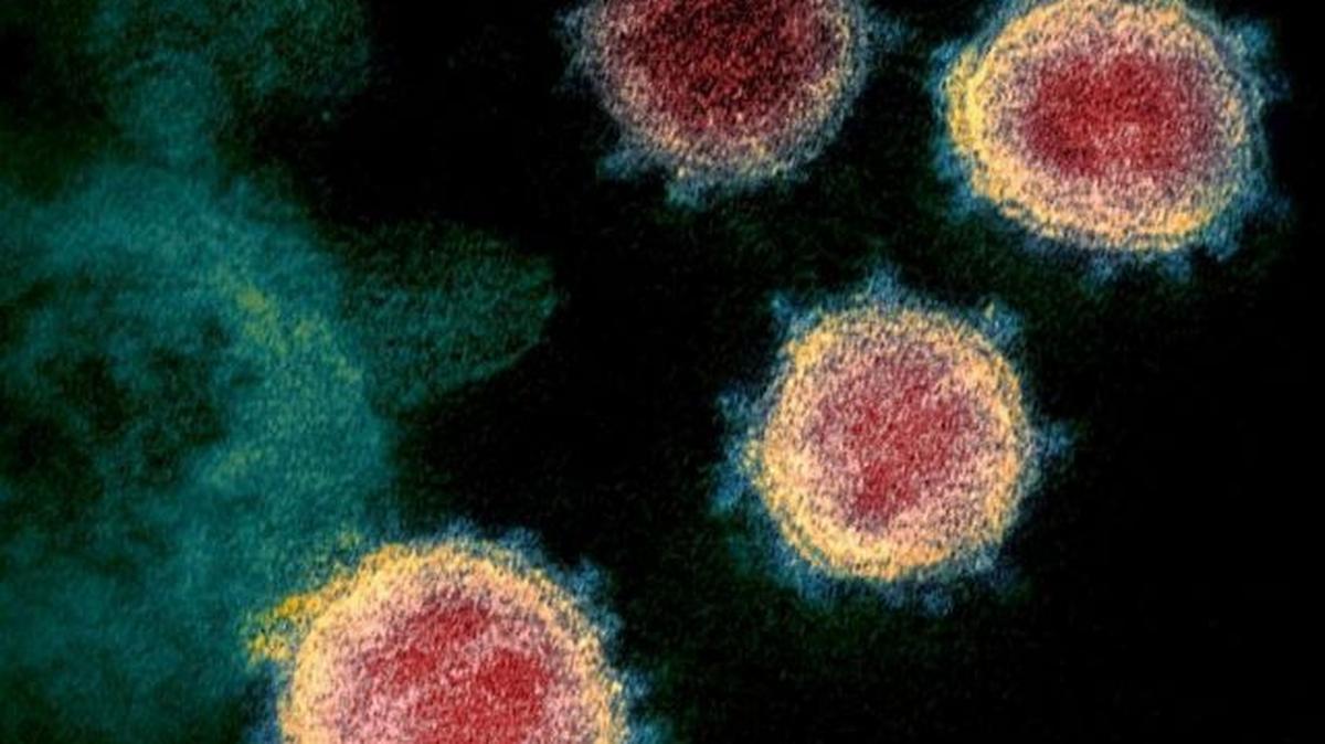 This illustration obtained on Feb. 27, 2020, courtesy of the National Institutes of Health, shows a transmission electron microscope image showing the coronavirus. (Handout photo)