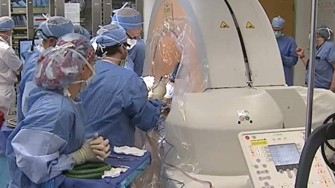 A study is exploring deep brain stimulation for stroke recovery